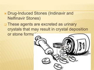  Drug-Induced Stones (Indinavir and
  Nelfinavir Stones)
 These agents are excreted as urinary
  crystals that may result in crystal deposition
  or stone formation
 