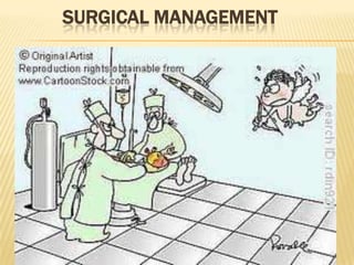 SURGICAL MANAGEMENT
 