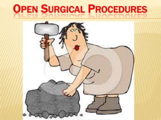 OPEN SURGICAL PROCEDURES
 