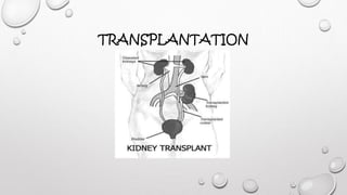 TRANSPLANTATION 
 