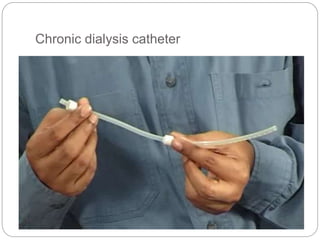 Chronic dialysis catheter
 