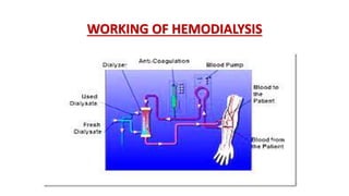 WORKING OF HEMODIALYSIS
 