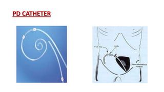 PD CATHETER
 