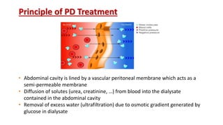 • Abdominal cavity is lined by a vascular peritoneal membrane which acts as a
semi-permeable membrane
• Diffusion of solutes (urea, creatinine, …) from blood into the dialysate
contained in the abdominal cavity
• Removal of excess water (ultrafiltration) due to osmotic gradient generated by
glucose in dialysate
Principle of PD Treatment
 