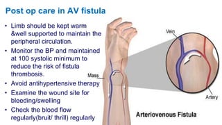 Post op care in AV fistula
• Limb should be kept warm
&well supported to maintain the
peripheral circulation.
• Monitor the BP and maintained
at 100 systolic minimum to
reduce the risk of fistula
thrombosis.
• Avoid antihypertensive therapy
• Examine the wound site for
bleeding/swelling
• Check the blood flow
regularly(bruit/ thrill) regularly
 