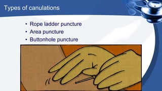 Types of canulations
• Rope ladder puncture
• Area puncture
• Buttonhole puncture
 