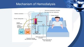 Mechanism of Hemodialysis
 
