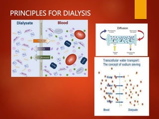 PRINCIPLES FOR DIALYSIS
 