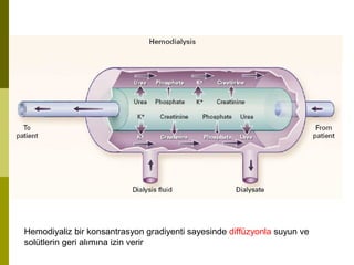 Hemodiyaliz bir konsantrasyon gradiyenti sayesinde diffüzyonla suyun ve
solütlerin geri alımına izin verir
 