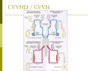 CVVHD / CVVH
 