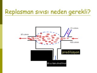 Replasman sıvısı neden gerekli?
predilüsyon
30 cc/dak ultrafiltrat
 