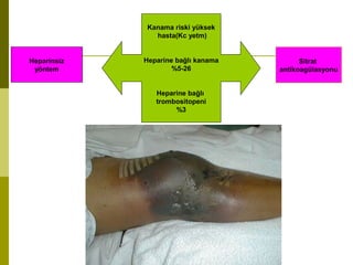 Kanama riski yüksek
hasta(Kc yetm)
Heparine bağlı kanama
%5-26
Heparine bağlı
trombositopeni
%3
Heparinsiz
yöntem
Sitrat
antikoagülasyonu
 
