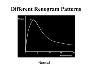 all about renal scan Renal Scintigraphy-.ppt