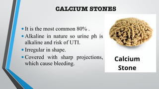 CALCIUM STONES
•It is the most common 80% .
•Alkaline in nature so urine ph is
alkaline and risk of UTI.
•Irregular in shape.
•Covered with sharp projections,
which cause bleeding.
 