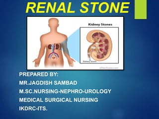 RENAL STONE
PREPARED BY:
MR.JAGDISH SAMBAD
M.SC.NURSING-NEPHRO-UROLOGY
MEDICAL SURGICAL NURSING
IKDRC-ITS.
 