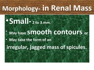 Morphology- in Renal Mass
•Small-2 to 3 mm.
• May have smooth contours or
• May take the form of an
irregular, jagged mass of spicules.
 