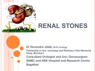 RENAL STONES
Dr Devendra Jalde, M.Ch Urology
Fellowship in Uro- oncology and Robotics (Tata Memorial
Hosp, Mumbai )
Consultant Urologist and Uro- Oncosurgeon
SNMC and HSK Hospital and Research Centre
Bagalkot
 