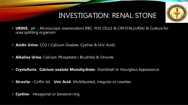 Kidney Stone By Dr Anil Kumar Associate Professor Aiims Patna
