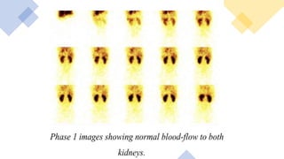 Renal system Imaging.pptx