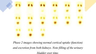 Renal system Imaging.pptx
