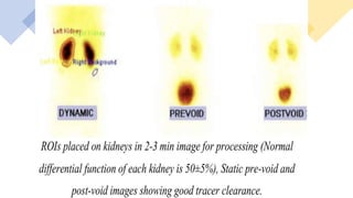 Renal system Imaging.pptx
