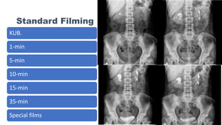 Standard Filming
KUB.
1-min
5-min
10-min
15-min
35-min
Special films
 