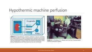 Hypothermic machine perfusion
DEPT OF UROLOGY, KMC AND GRH, CHENNAI 11
 