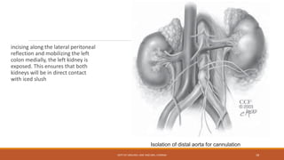 incising along the lateral peritoneal
reflection and mobilizing the left
colon medially, the left kidney is
exposed. This ensures that both
kidneys will be in direct contact
with iced slush
Isolation of distal aorta for cannulation
DEPT OF UROLOGY, KMC AND GRH, CHENNAI 18
 