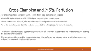 Cross-Clamping and In Situ Perfusion
The anaesthesiologist and other teams -notified that cross-clamping can proceed.
Mannitol (25 g) and heparin (250–300 U/kg) are administered intravenously.
A distal aorta is then exposed, and the umbilical tape along the distal aspect is secured.
An aortic cannula is placed on the field and connected via tubing to cold preservation solution
The anterior wall of the aorta is generously incised, and the cannula is placed within the aorta and secured by tying
the proximal umbilical tape .
The cannula must be passed far enough to be secured at its flange, but passage too far proximally may prevent
perfusion of lower pole renal arterial branches
DEPT OF UROLOGY, KMC AND GRH, CHENNAI 21
 