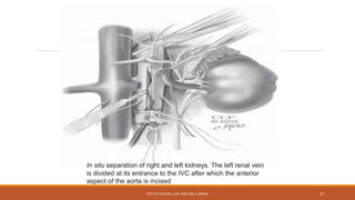 In situ separation of right and left kidneys. The left renal vein
is divided at its entrance to the IVC after which the anterior
aspect of the aorta is incised
DEPT OF UROLOGY, KMC AND GRH, CHENNAI 27
 