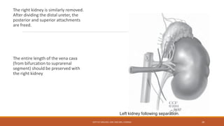 The right kidney is similarly removed.
After dividing the distal ureter, the
posterior and superior attachments
are freed.
The entire length of the vena cava
(from bifurcation to suprarenal
segment) should be preserved with
the right kidney
Left kidney following separation.
DEPT OF UROLOGY, KMC AND GRH, CHENNAI 28
 