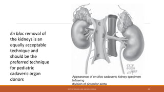 En bloc removal of
the kidneys is an
equally acceptable
technique and
should be the
preferred technique
for pediatric
cadaveric organ
donors
Appearance of en bloc cadaveric kidney specimen
following
division of posterior aorta
DEPT OF UROLOGY, KMC AND GRH, CHENNAI 29
 