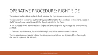 OPERATIVE PROCEDURE: RIGHT SIDE
The patient is placed in the classic flank position for right donor nephrectomy.
The down side is supported by the kidney rest of the table, then the table is flexed and placed in
slight Trendelenburg position until the flank is parallel to the floor.
A roll is placed in the downside axilla to prevent brachial plexus injury. Legs are appropriately
padded.
11th rib bed incision made, Total incision length should be no more than 15-18 cm.
The retroperitoneum is entered and the diaphragm and pleura are dissected free from under
the lateral aspect of the 11th rib
DEPT OF UROLOGY, KMC AND GRH, CHENNAI 38
 