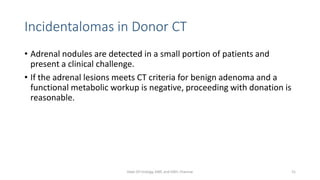 Incidentalomas in Donor CT
• Adrenal nodules are detected in a small portion of patients and
present a clinical challenge.
• If the adrenal lesions meets CT criteria for benign adenoma and a
functional metabolic workup is negative, proceeding with donation is
reasonable.
Dept Of Urology, KMC and GRH, Chennai 51
 