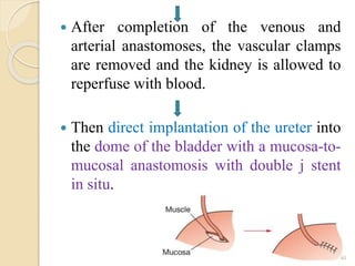  After completion of the venous and
arterial anastomoses, the vascular clamps
are removed and the kidney is allowed to
reperfuse with blood.
 Then direct implantation of the ureter into
the dome of the bladder with a mucosa-to-
mucosal anastomosis with double j stent
in situ.
40
 