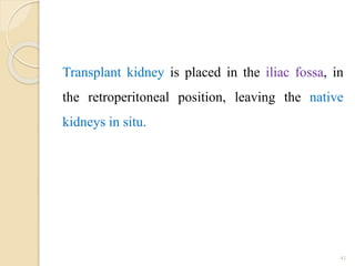 Transplant kidney is placed in the iliac fossa, in
the retroperitoneal position, leaving the native
kidneys in situ.
41
 
