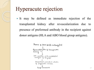 Hyperacute rejection
 It may be defined as immediate rejection of the
transplanted kidney after revascularization due to
presence of preformed antibody in the recipient against
donor antigens (HLA and ABO blood group antigens).
47
 