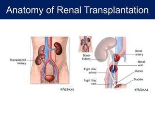 Anatomy of Renal Transplantation
 
