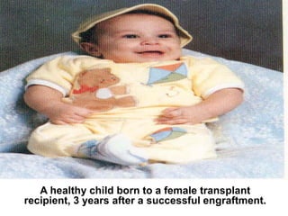 A healthy child born to a female transplant
recipient, 3 years after a successful engraftment.
 
