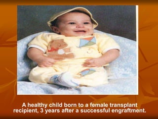 A healthy child born to a female transplant
recipient, 3 years after a successful engraftment.
 