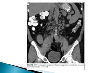 Renal transplant imaging