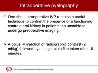 Click to edit Master title style
Shaukat Khanum Memorial Cancer Hospital and Research Centre
Intraoperative pyelography
 One-shot, intraoperative IVP remains a useful
technique to confirm the presence of a functioning
contralateral kidney in patients too unstable to
undergo preoperative imaging.
 A bolus IV injection of radiographic contrast (2
ml/kg) followed by a single plain film taken after 10
minutes.
 