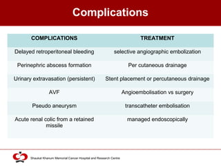 Click to edit Master title style
Shaukat Khanum Memorial Cancer Hospital and Research Centre
Complications
COMPLICATIONS TREATMENT
Delayed retroperitoneal bleeding selective angiographic embolization
Perinephric abscess formation Per cutaneous drainage
Urinary extravasation (persistent) Stent placement or percutaneous drainage
AVF Angioembolisation vs surgery
Pseudo aneurysm transcatheter embolisation
Acute renal colic from a retained
missile
managed endoscopically
 