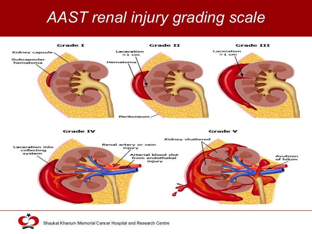 Renal trauma