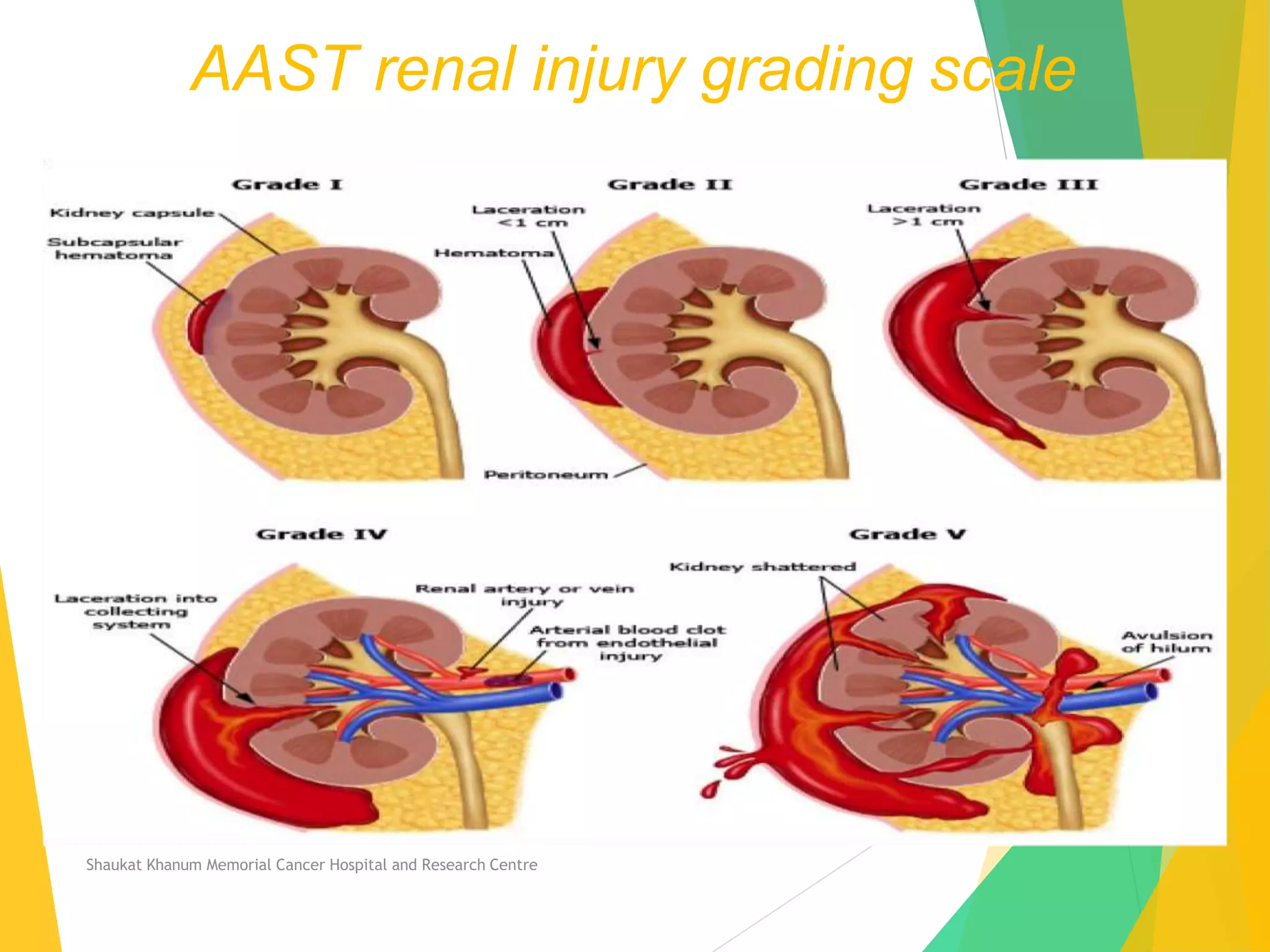 Management of Renal trauma | PPTX