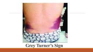 Grey Turner’s Sign
 