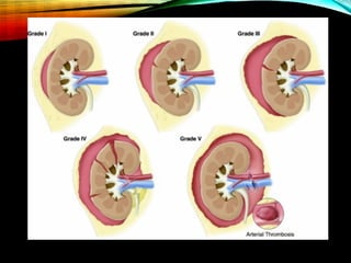 Renal Trauma.pdf