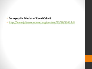 • Sonographic Mimics of Renal Calculi
• http://www.jultrasoundmed.org/content/23/10/1361.full
 