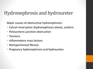 Hydronephrosis and hydroureter
Major causes of obstructive hydronephrosis:
• Calculi-renal pelvic (hydronephrosis alone), ureteric
• Pelviureteric junction obstruction
• Tumours
• Inflammatory mass lesions
• Retroperitoneal fibrosis
• Pregnancy hydronephrosis and hydroureter.
 