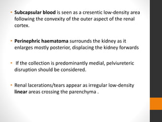 • Subcapsular blood is seen as a cresentic low-density area
following the convexity of the outer aspect of the renal
cortex.
• Perinephric haematoma surrounds the kidney as it
enlarges mostly posterior, displacing the kidney forwards
• If the collection is predominantly medial, pelviureteric
disruption should be considered.
• Renal lacerations/tears appear as irregular low-density
linear areas crossing the parenchyma .
 